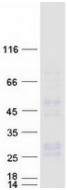 Coomassie blue staining of purified CD70 protein.